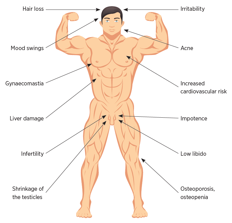 Androgenic adverse effects in men