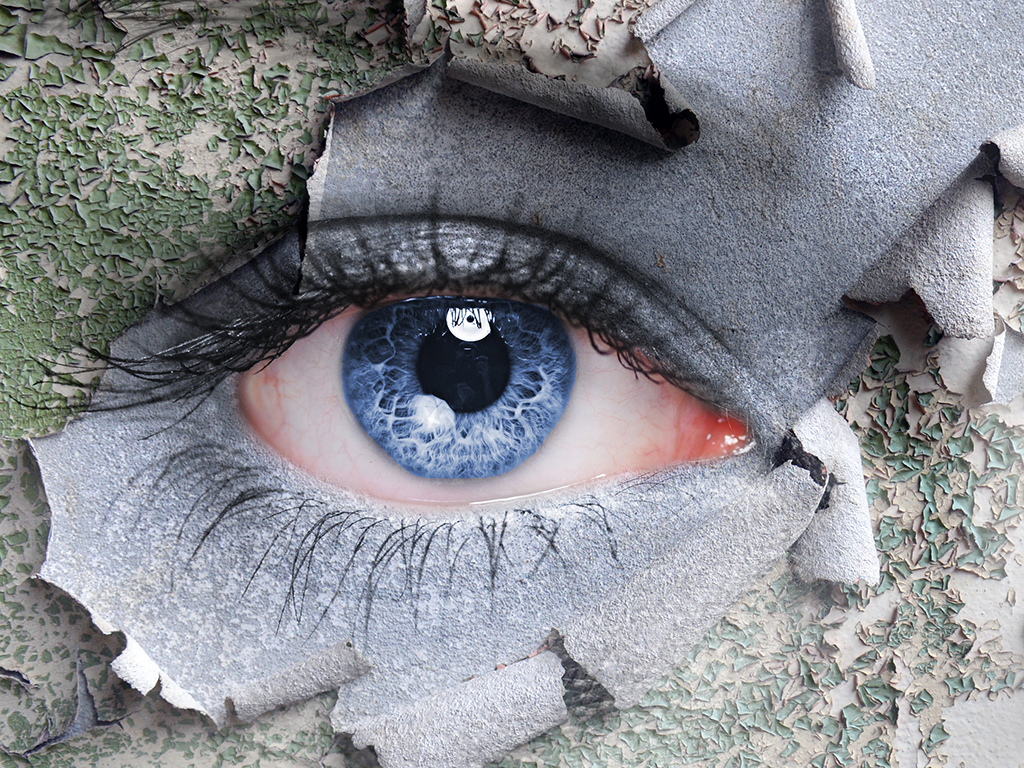 Dry eye disease when to treat and when to refer