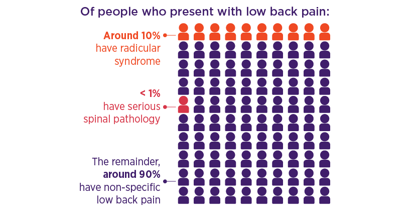Infographic showing 100 people, of whom around 10% have radicular syndrome, < 1% have serious spinal pathology and the remainder, around 90%, have non-specific low back pain.