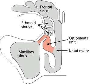 Treating Acute Sinusitis Australian Prescriber Treating Acute Sinusitis Australian Prescriber