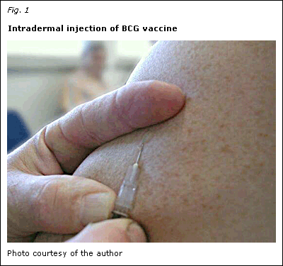 Intradermal injection of BCG vaccine