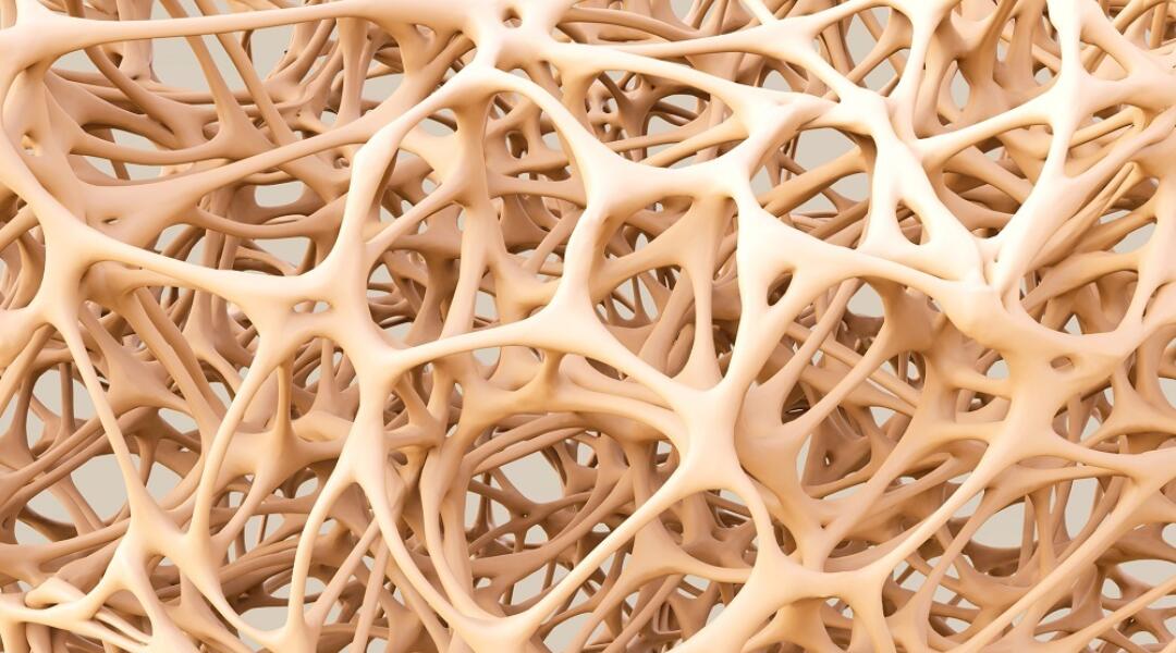 Osteoporosis: Data insights help build better bones
