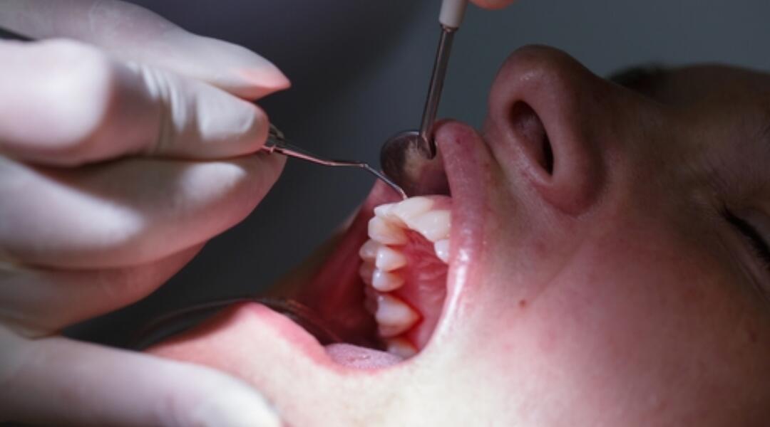 Sore mouth