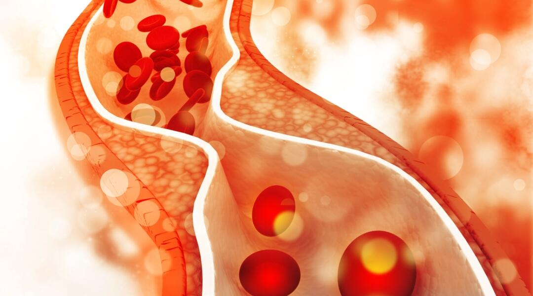 Statins revisited – appropriate patient selection and management are key