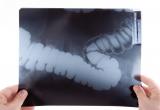 abdominal X-ray
