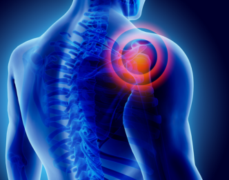 Medicinewise News: Non-traumatic shoulder pain in general practice: a pragmatic approach to diagnosis