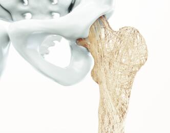 Bone Health Action Plan