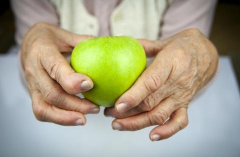 Shared care approaches to rheumatoid arthritis: supporting early and sustained methotrexate