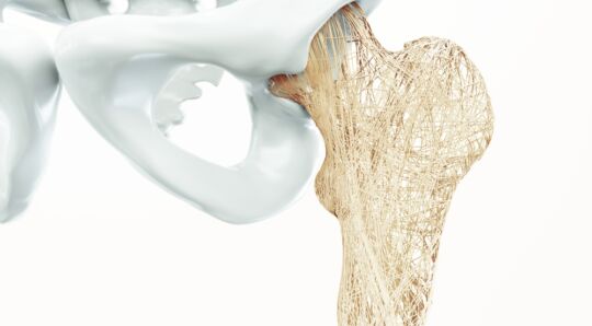 Osteoporosis