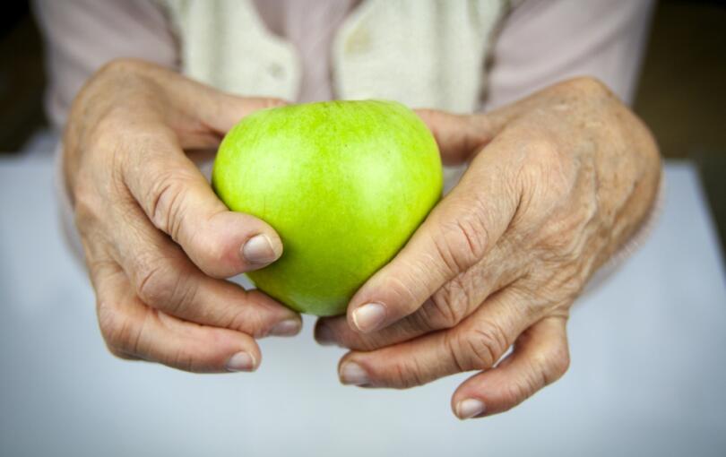 Shared care approaches to rheumatoid arthritis: supporting early and sustained methotrexate