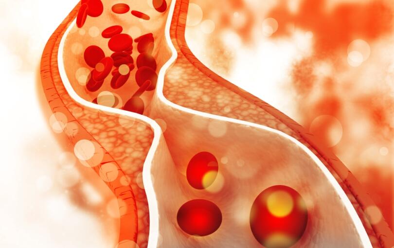 Absolute Cardiovascular Risk Assessment Chart