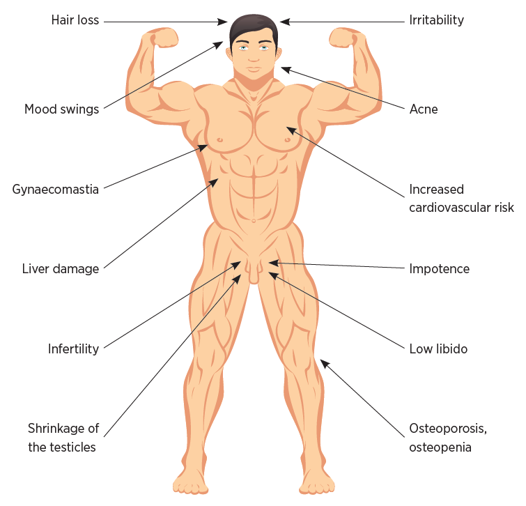 anabolic steroids side effects list