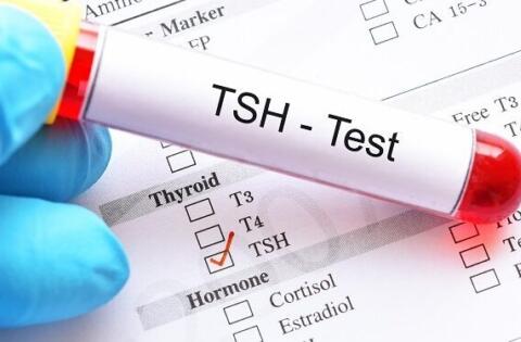 Thyroid disorders: test, treat, refer?