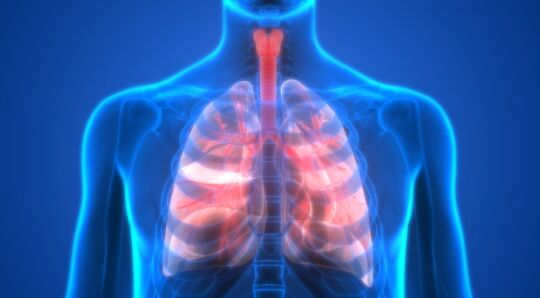 Chronic obstructive pulmonary disease (COPD)