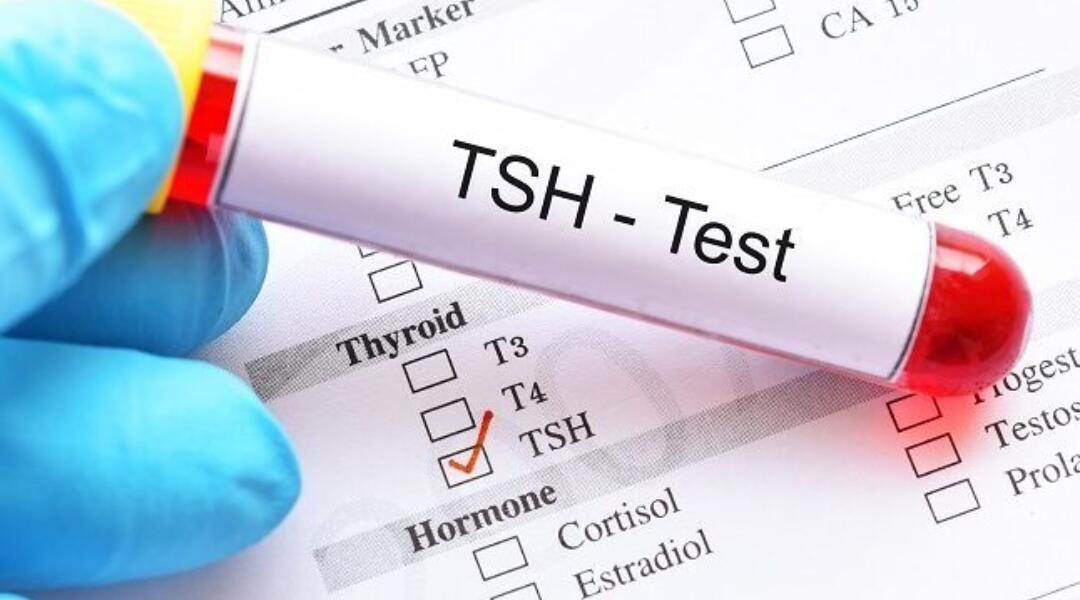 Thyroid disorders: test, treat, refer?