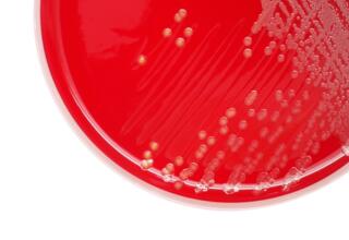 Antimicrobials: bacteraemia